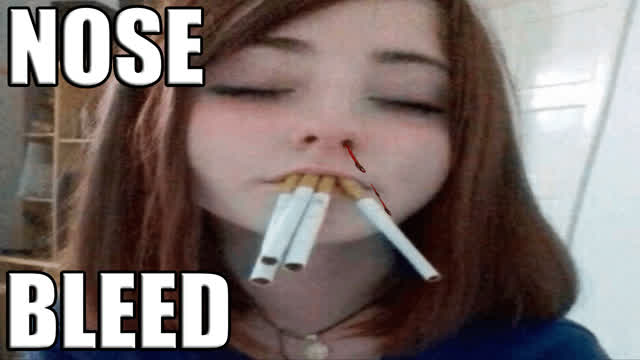 ☆NOSE BLEED☆